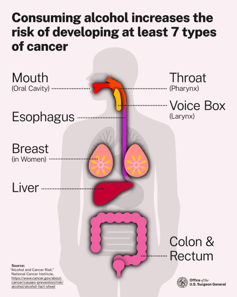 Dibujo del cuerpo humano donde se señalan los 7 tipos de cáncer en los cuales el alcohol afecta directamente